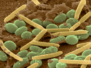 Enlarged view: Myxococcus Bantus (Photo: J. Berger/S. Kadam)